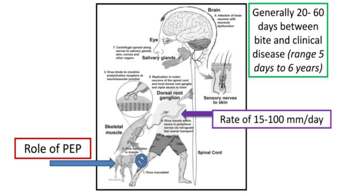 狂犬病毒致死机制