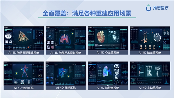 ge医疗怎么样CMEF收官| 推想医疗,用AI照亮未来_新闻资讯_第4张_活检穿刺产品网 ge医疗怎么样CMEF收官| 推想医疗,用AI照亮未来_https://www.jmylbn.com_新闻资讯_第4张