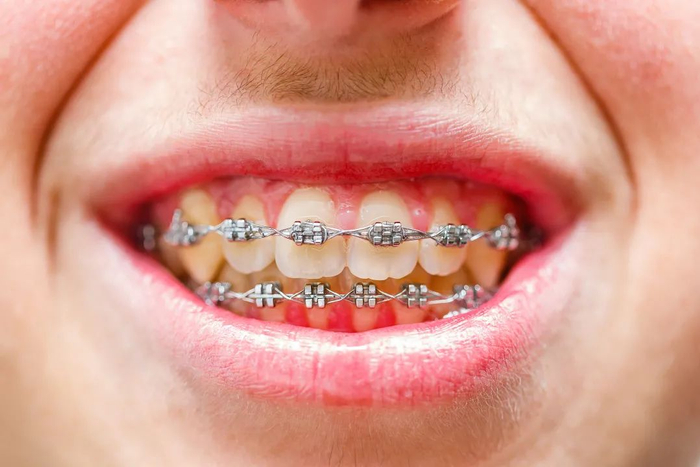 图片来源：视觉中国