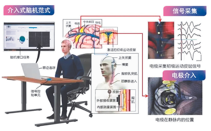     介入式脑机接口示意图