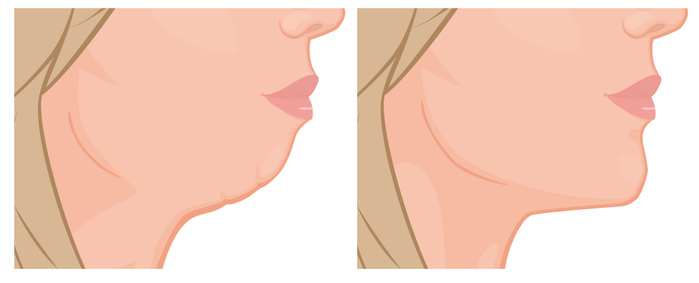 图片来源：站酷海洛