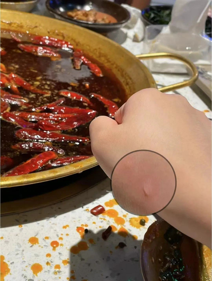 ◎火锅店须有防烫伤措施，图源小红书