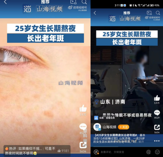 热搜上关于25岁女生老年斑的报道。图源：微博截图