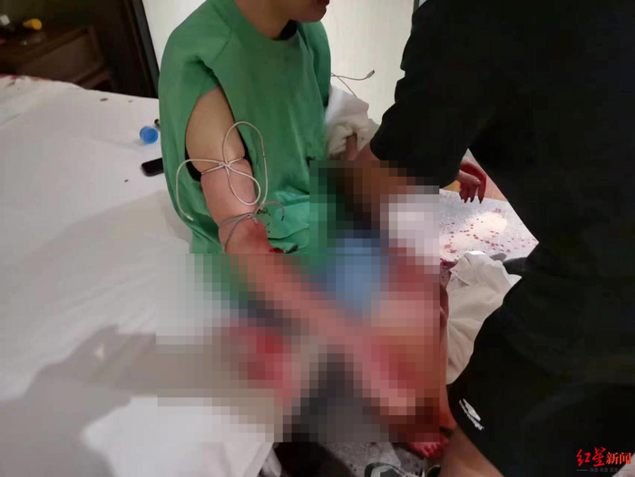 ↑事发后麦女士亲友赶到帮助其止血&nbsp;