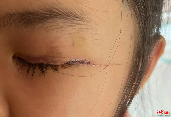 ↑小花眼睑部位受伤