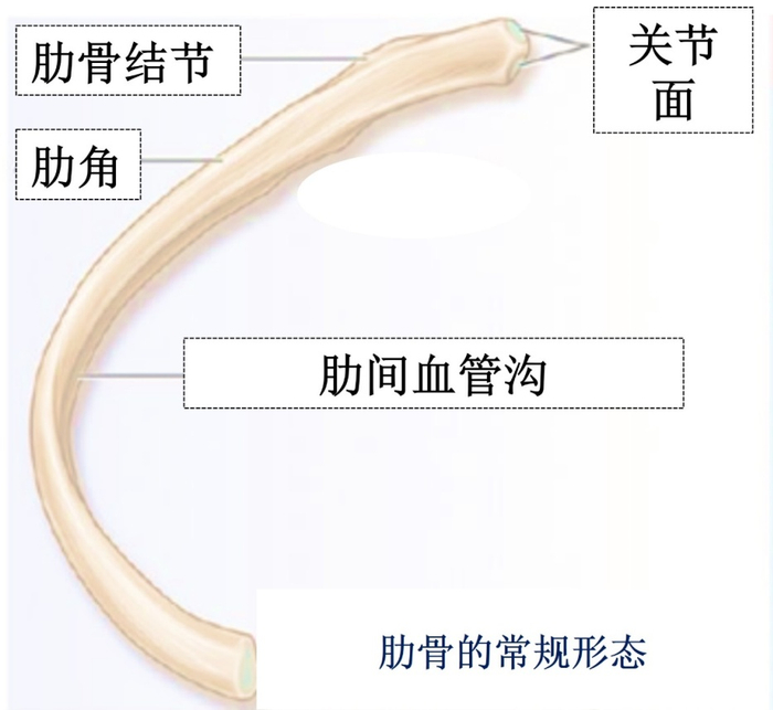 图3肋骨的形态  