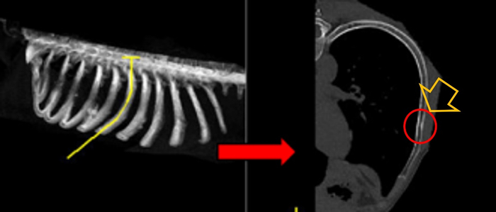 图2左侧的图像处理后得到右侧的曲面重组图像用于直观诊断  