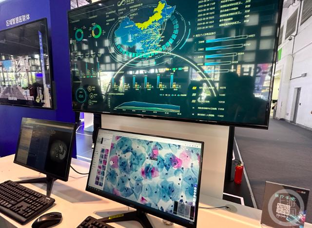 ▲商汤科技的智慧医疗系统。摄影/上游新闻记者 时婷婷