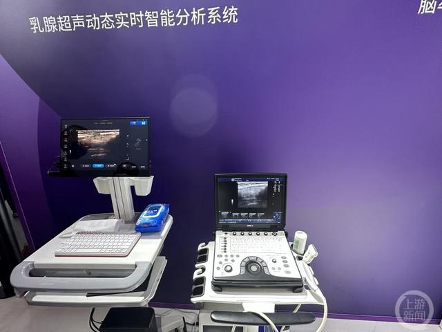 ▲全球首款乳腺超声动态实时智能分析系统是GE医疗首次展出的产品。摄影/上游新闻记者 时婷婷