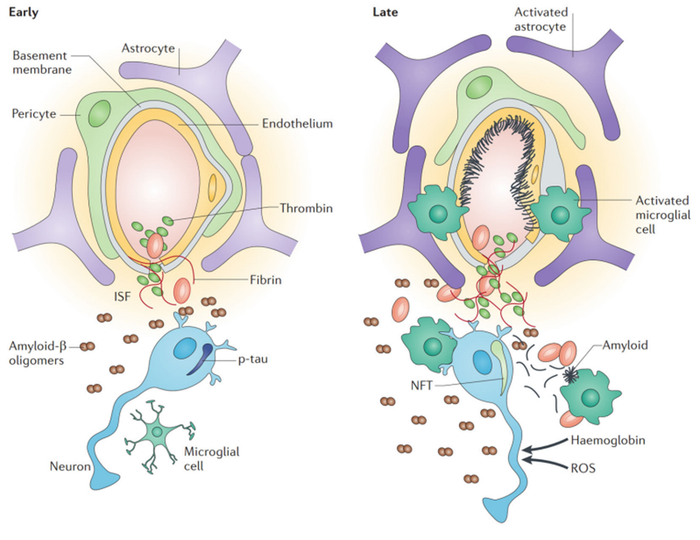 图1. 阿尔茨海默病血管损伤模型