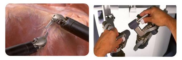 机械臂映射医生动作示意图