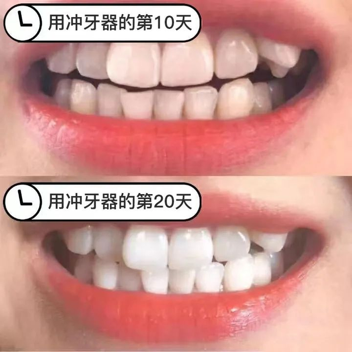 *使用效果因人而异哦