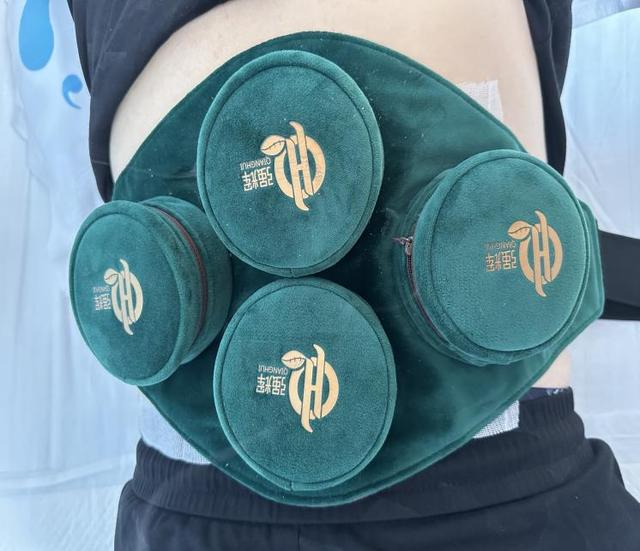 ▲隔物灸/图源 江北区中医院