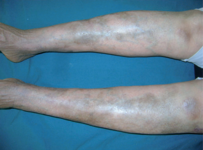 图片来源于参考文献4