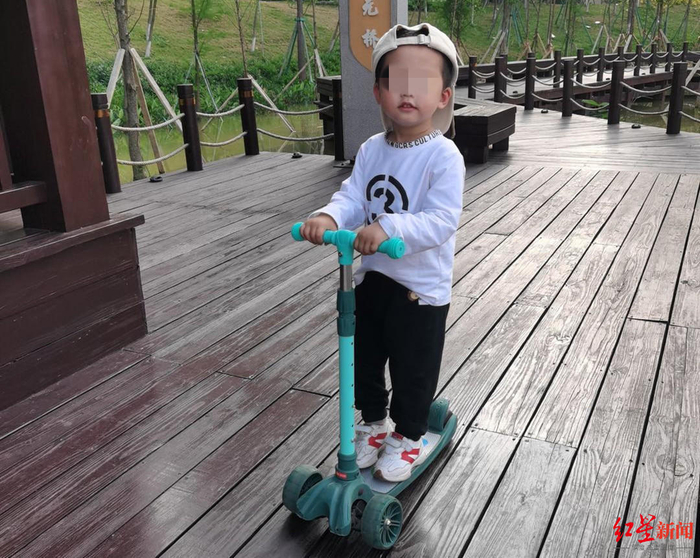 ▲小源术前照片 家属供图