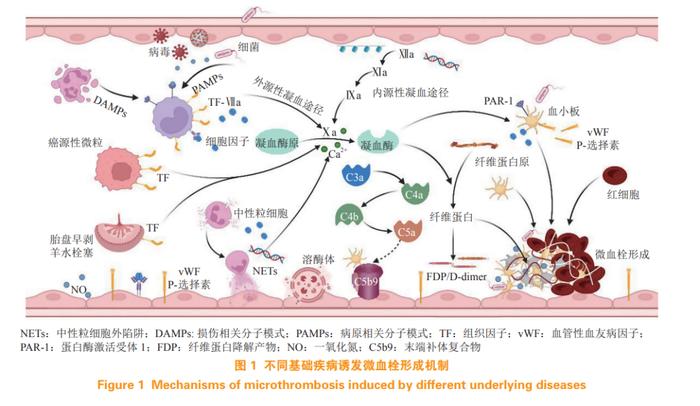 独家原创 | 胡庆华教授：弥散性血管内凝血的发病机制及药物治疗进展