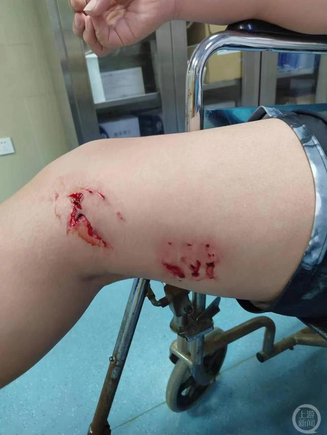 ▲儿童受伤部位。图片来源/受访者