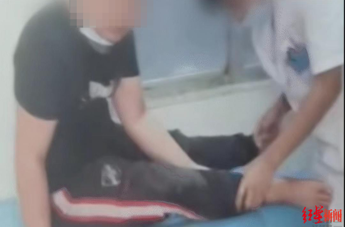 ▲阿飞逃出公司后，右脚受伤，被带到缅北当地一家医院治疗