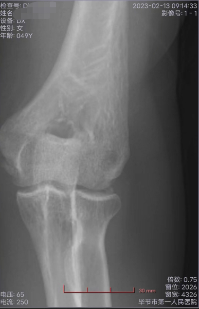 ▲王某在毕节市第一人民医院进行检查