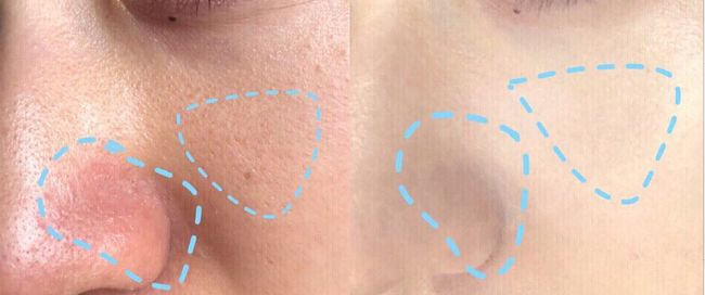 △图源用户反馈