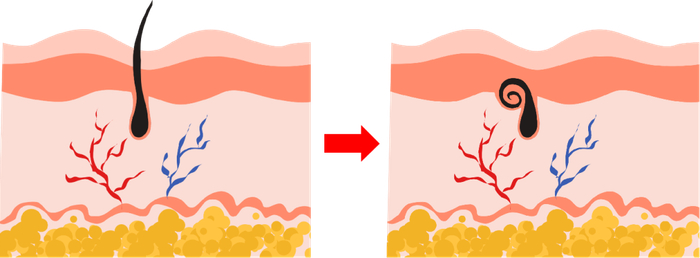 图3. 裸鼠毛发生长示意图