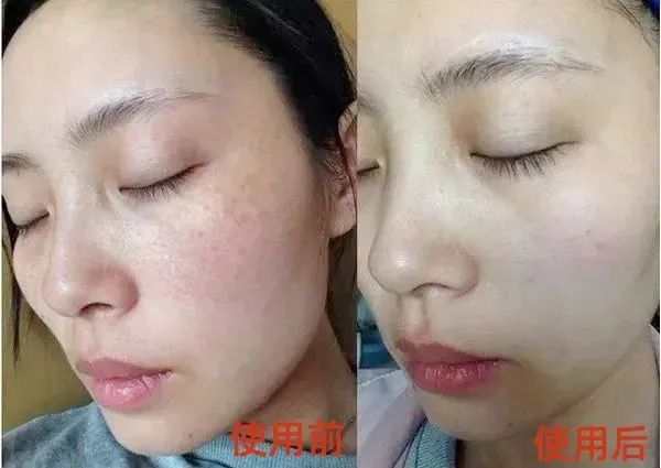 因个人肤质差异，具体效果因人而异