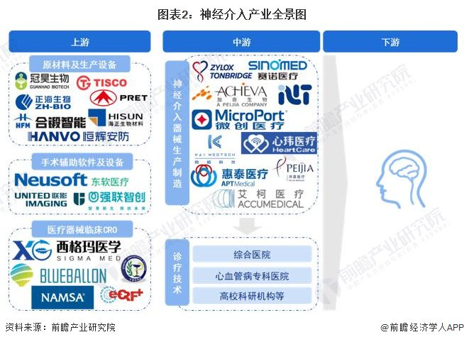神经介入产业链区域热力地图：北京和上海神经介入产业竞争力最强