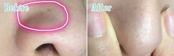 图片仅供参考，效果因人而异