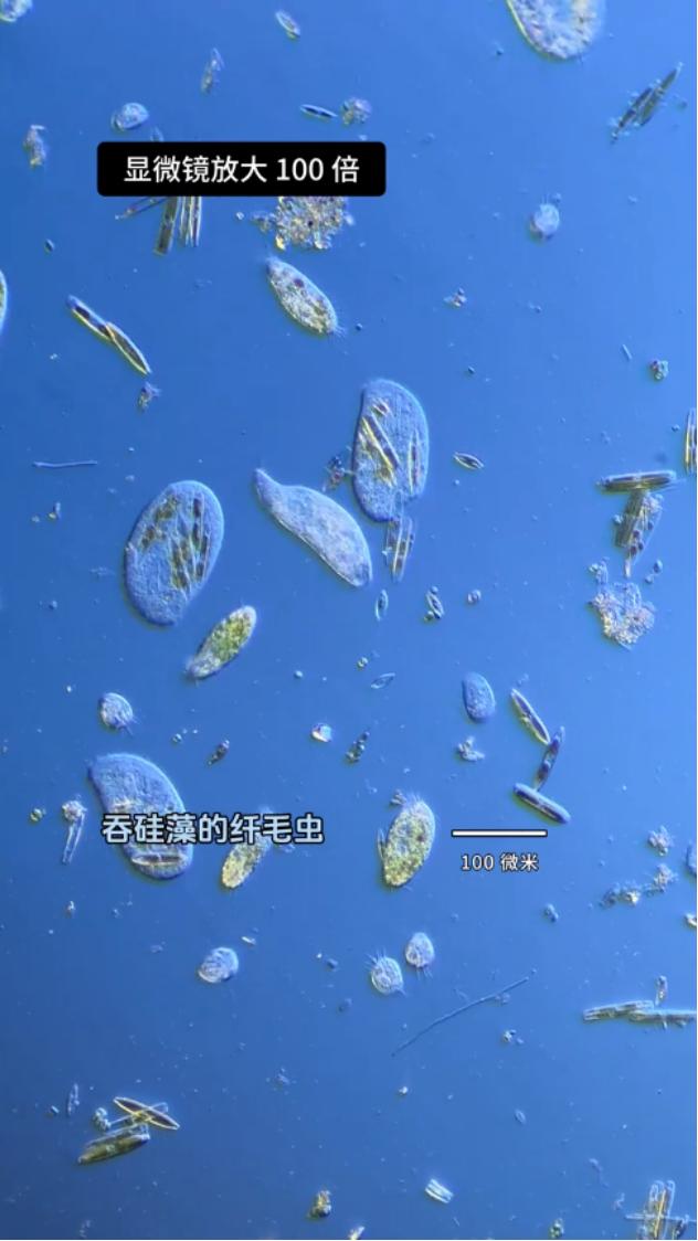 把一滴水拍成微缩宇宙,小伙自制显微镜拍摄微生物在抖音走红