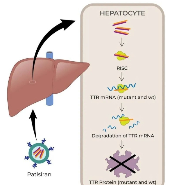图2：Patisiran作用机制图