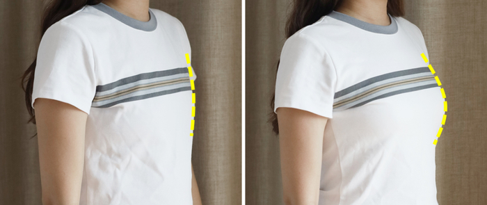 △（左）普通无钢圈内衣：紧绷压胸，没有胸型；