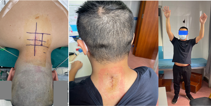 患者术前及术后。