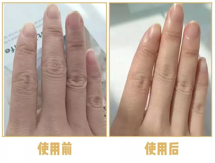 *使用效果因人而异