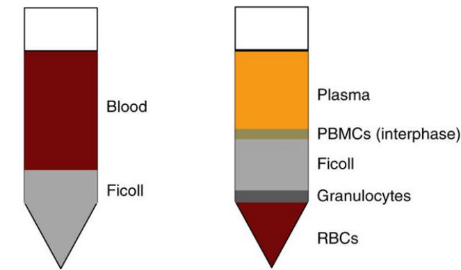 图2 抗凝血中加入Ficoll后图示（左）；离心分层后图示（右图）