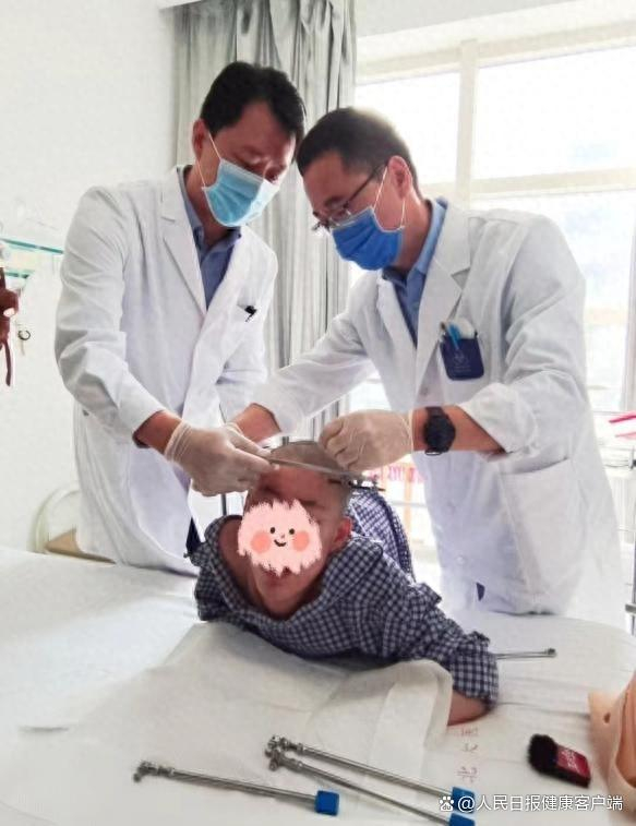 北京大学第一医院骨科主任医师王宇（左一）和同事为姜延琛摘取头盆环。受访者供图