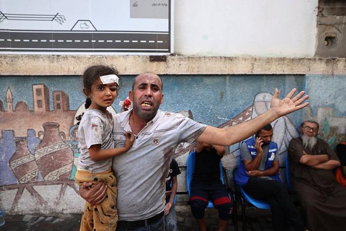 以色列对加沙地带空袭后，巴勒斯坦男子抱着受伤的女孩。