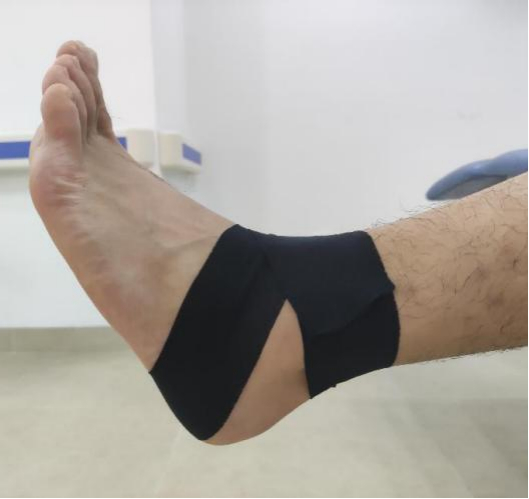 踝关节的防护贴扎。郭晓宇 摄