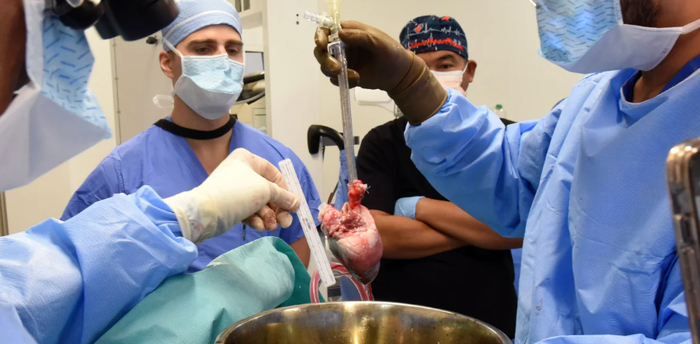 移植手术前的准备