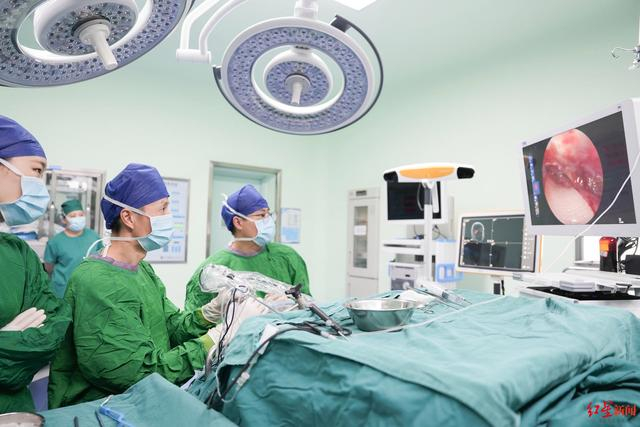 ▲医生正在为患者进行手术