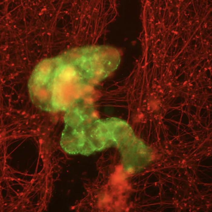▲机器人（绿色部分）在穿过受损神经细胞（红色部分）时，能促进神经细胞受损区域生长