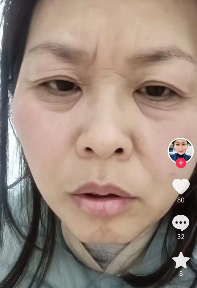 山东一女子发视频称自己20天内容貌出现“断崖式衰老”。  网络视频截图