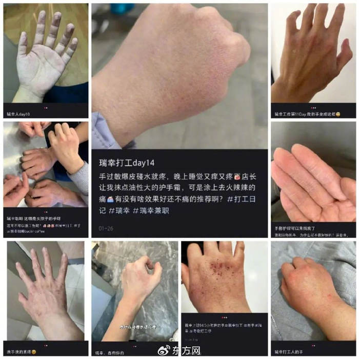 △社交平台上发帖者们发布的“烂手照”（图片来源：社交平台截图）