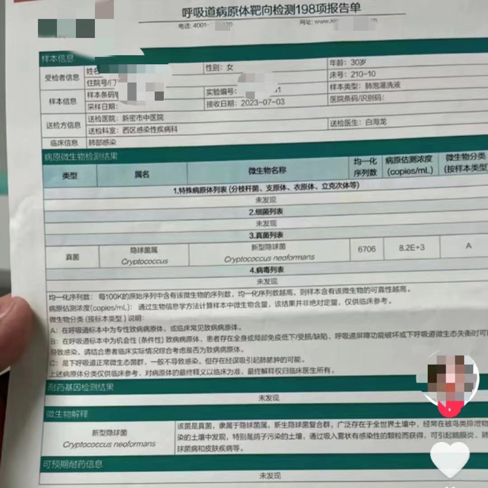 ▲医院检测何女士感染新型隐球菌