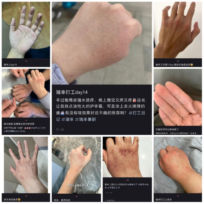 图说：社交平台上发帖者们发布的“烂手照”。图源：社交平台截图