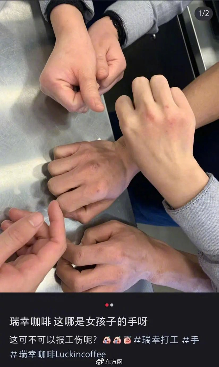 △社交平台上，不少人提问“烂手”是否算工伤（图片来源：社交平台截图）