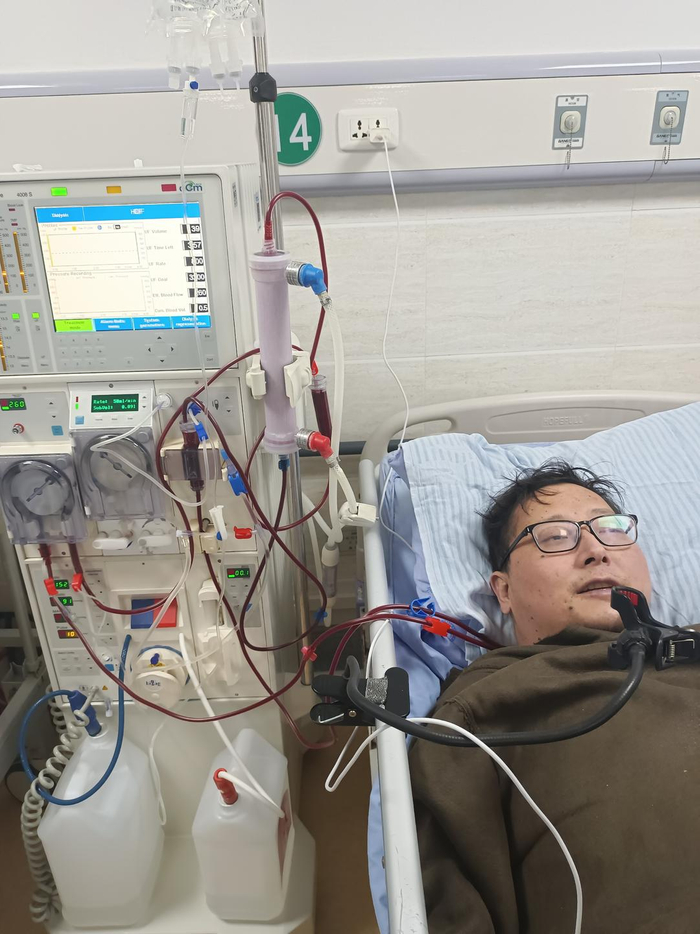 ▲患病后李飞飞在医院透析