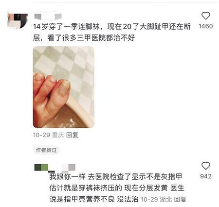     网友吐槽“光腿神器”像“刑具”