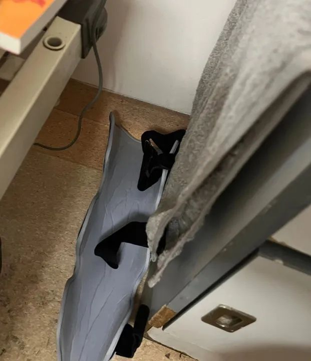 向建军当时离开医院时用的固定支架。杨书源  摄