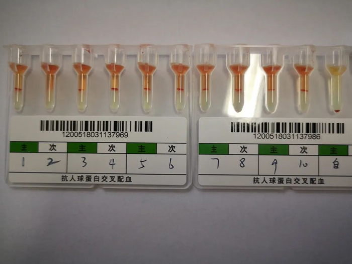 不规则抗体（抗Tja抗体）鉴定结果