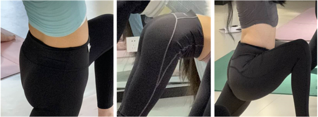 △运动中出现瑜伽裤面料卷边、掉档、不贴合等情况